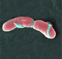 מימין: Campylobacter jejuni (צילום: CDC); משמאל: Listeria monocytogenes (צילום: AJC1)
