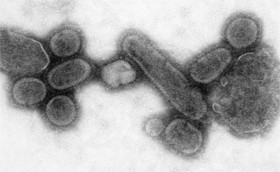נגיף שפעת (A (H1N1 בזיהום מתרבית שמקורה במגיפה של 1918 (תצלום: Cynthia Goldsmith, CDC)
