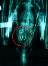 קרס דיג בצילום רנטגן